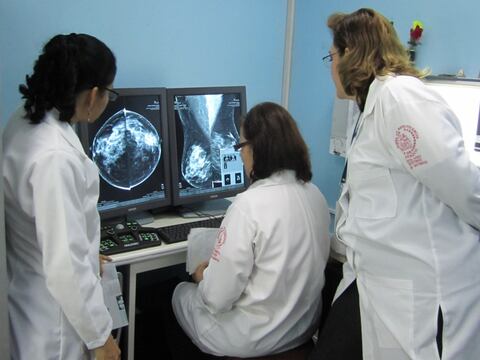 Actualmente se busca preservar el seno y no extirparlo al tratar cáncer de mama en Ecuador