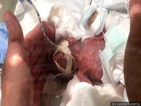 El bebé "más pequeño del mundo": dan de alta a un recién nacido que pesó solo 268 gramos en Japón