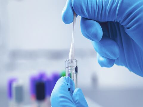Roche traerá a Ecuador prueba de antígeno para diagnosticar en menor tiempo el virus que ocasiona el COVID-19